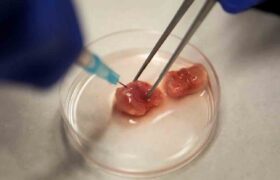 Brasil avanza en una prometedora cura contra el cáncer