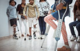 IVIC: Niños con pseudoartrosis congénita tratados con células madre evolucionan satisfactoriamente