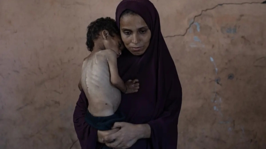 hambruna gaza