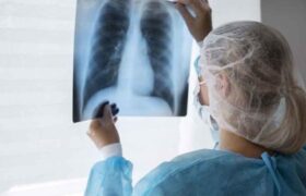 OMS impulsará nueva estrategia mundial contra la tuberculosis