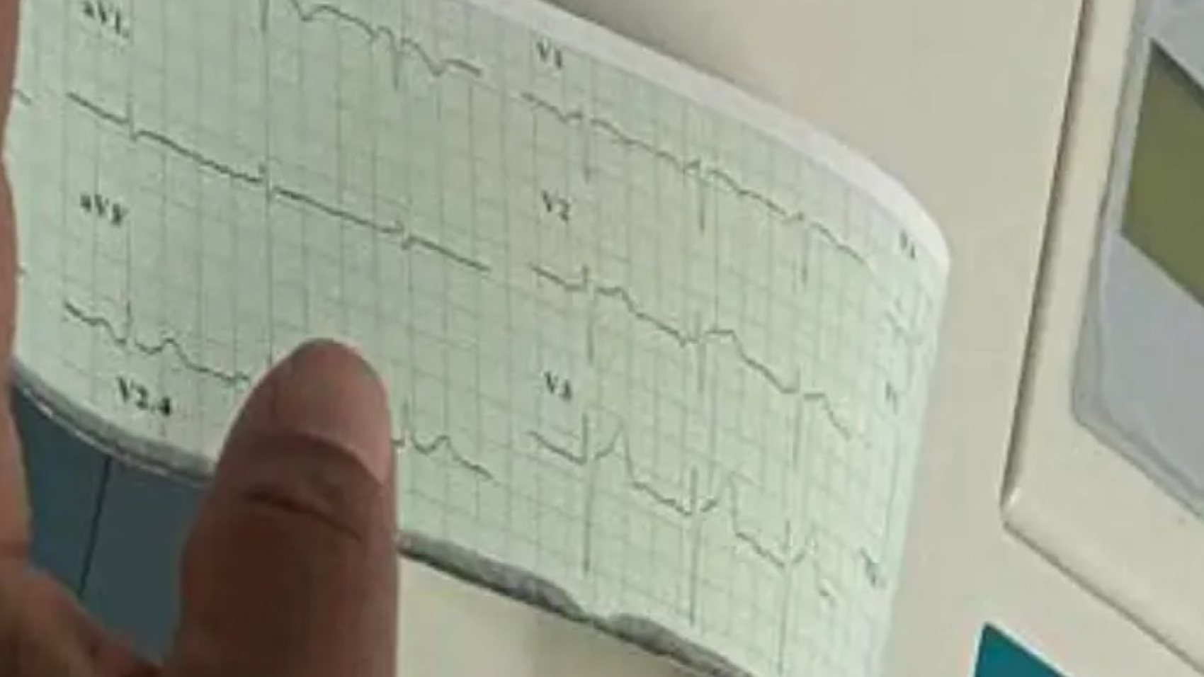 jornada cardiovascular66