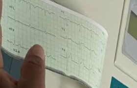 Jornada de atención médica cardiovascular atendió a más de 100 pacientes en Amazonas